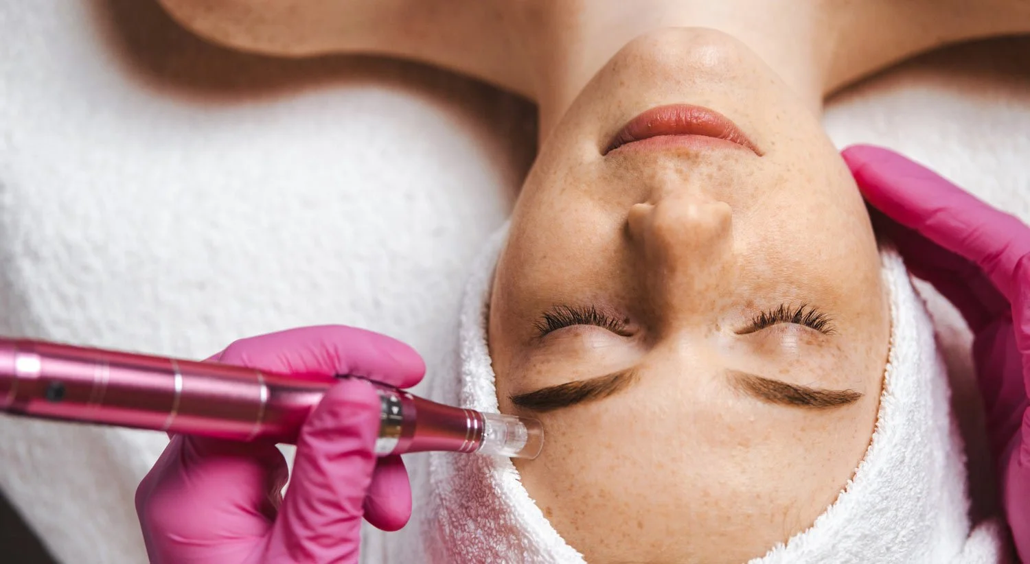Skin Treatments in Manotick