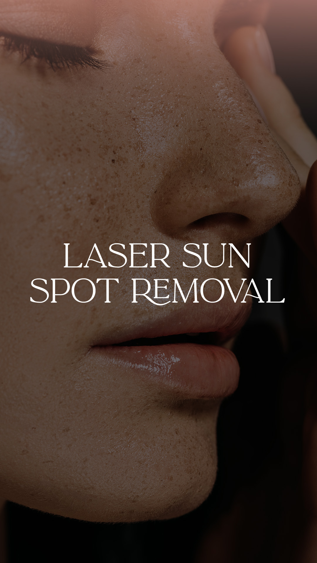 laser sun removal