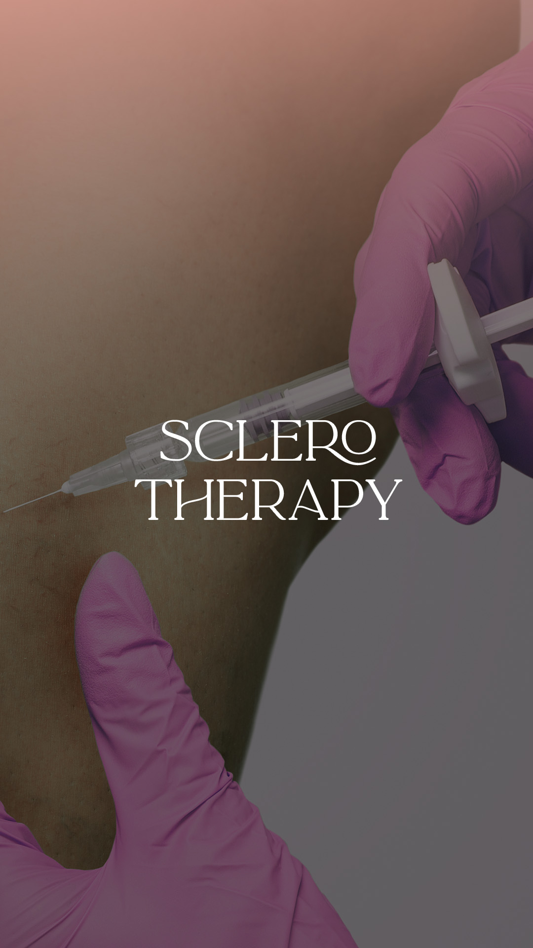 sclero theraphy
