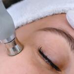 Pre-Summer Skin Prep: Top Treatments in Manotick, Ottawa & Barrhaven for Glowing Skin in 2026