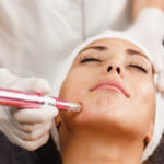 Microneedling in Manotick: How It Works, Benefits, and Why It’s One of 2026’s Most Popular Skin Treatments