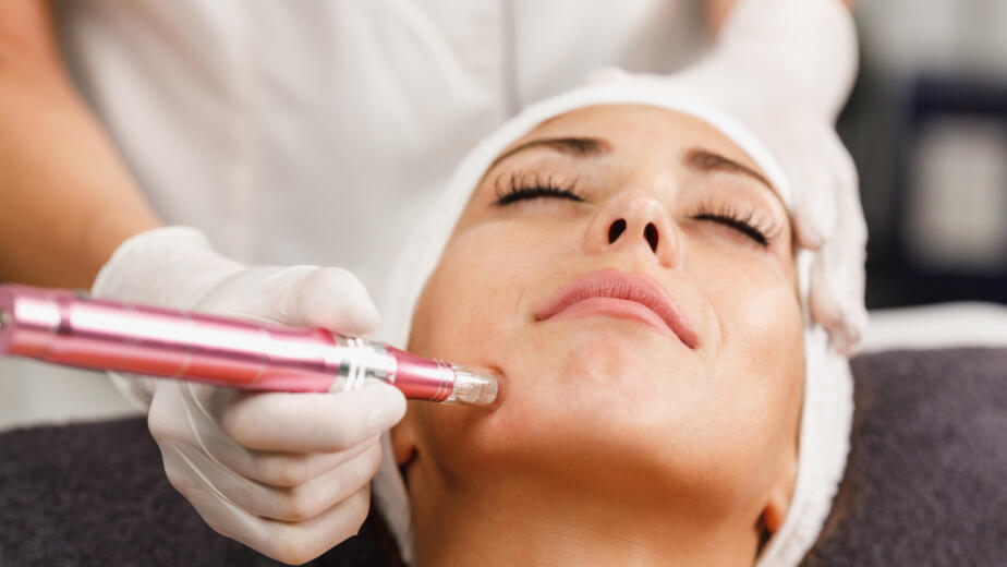 Microneedling in Manotick How It Works, Benefits, and Why It’s One of 2026’s Most Popular Skin Treatments